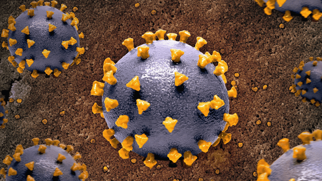 Measles Resurgence in the U.S. Raises Public Health Alarms