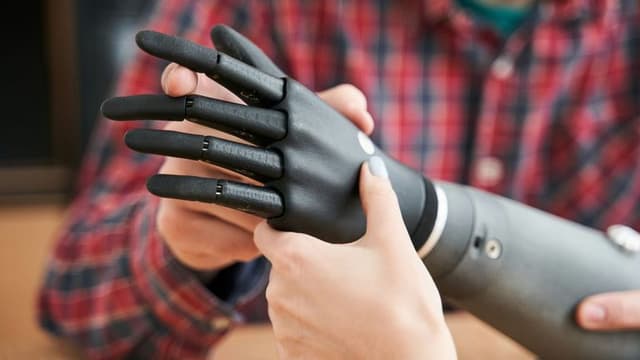 AI-Powered Prosthetics Revolutionize Mobility for Amputees