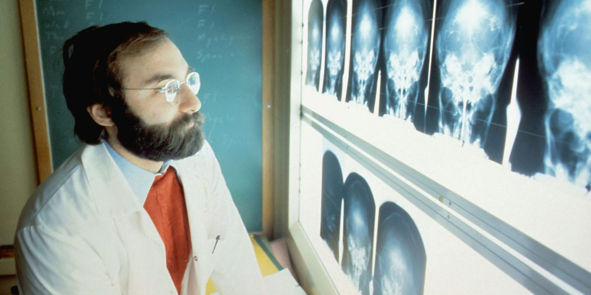 Breakthrough in Alzheimer’s Research Offers Hope for Millions of Americans