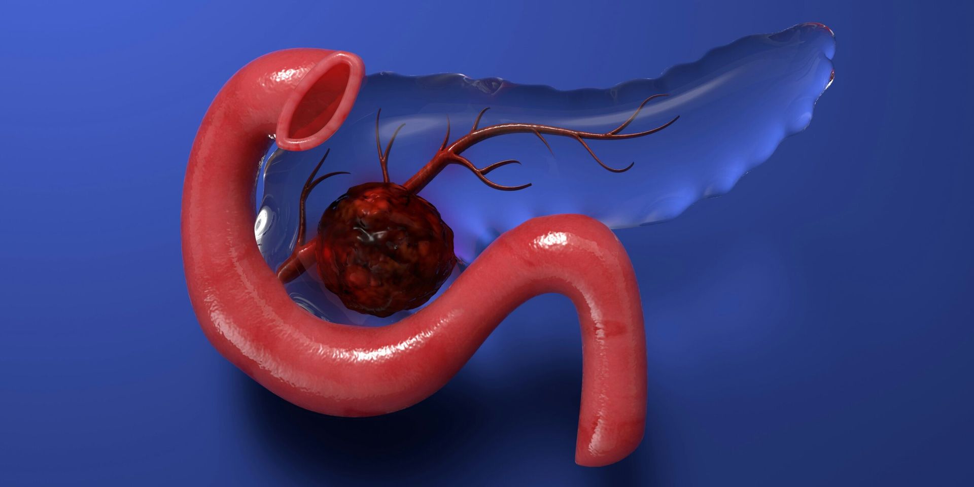 Gut Bacteria and Heart Disease: Groundbreaking Study Reveals New Cardiovascular Risk Clues
