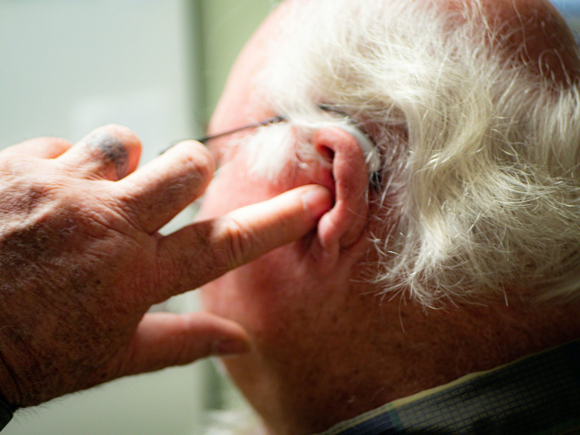 Breakthrough in Alzheimer’s Treatment: New Drug Shows Promise in Reversing Cognitive Decline