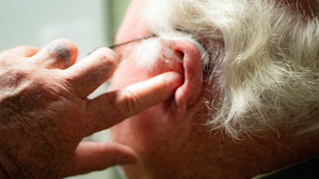 Breakthrough in Alzheimer’s Treatment: New Drug Shows Promise in Reversing Cognitive Decline