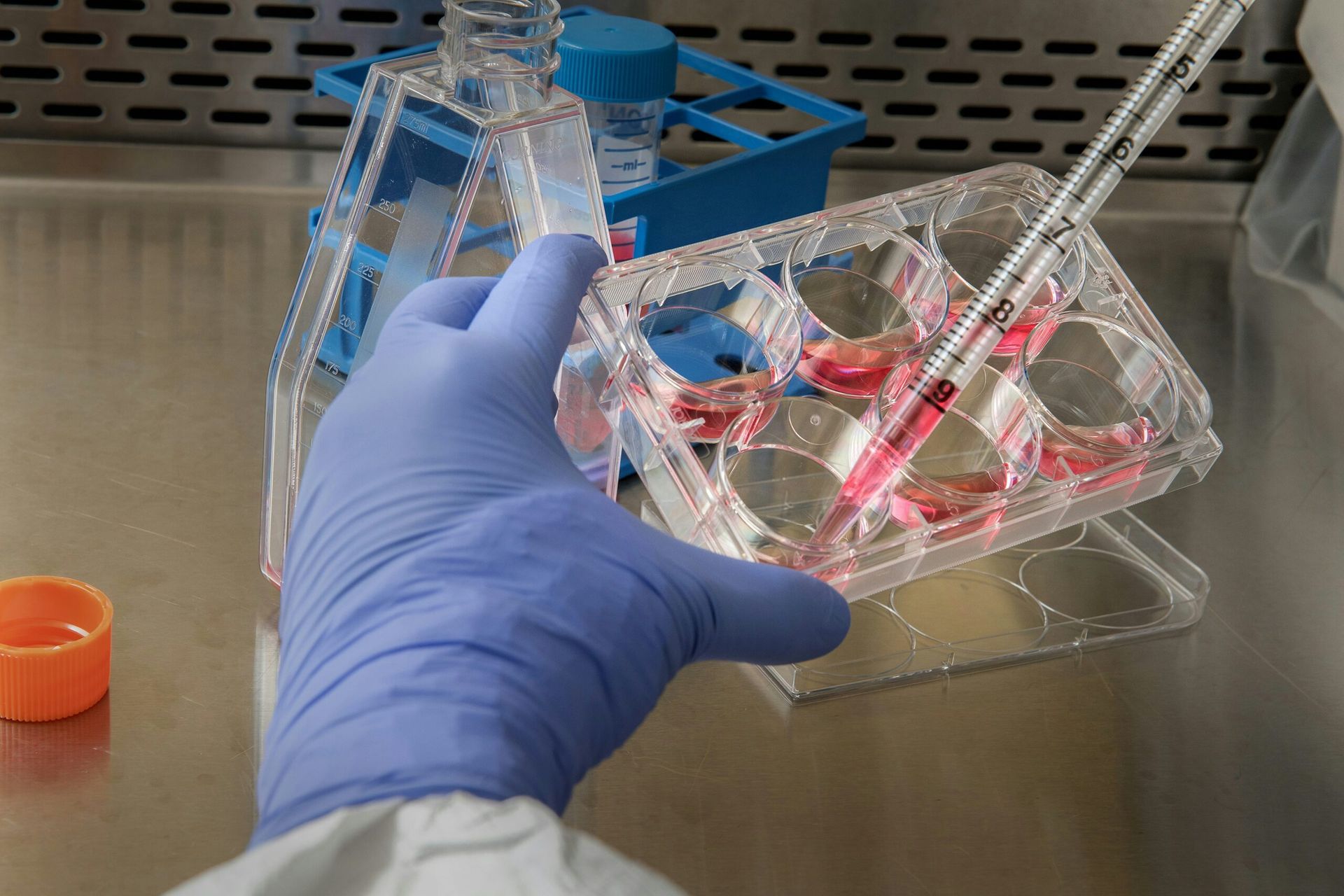 Revolutionary Gene Editing Trial Shows Promise for Sickle Cell Cure in First Patients