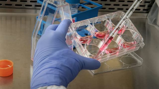 Revolutionary Gene Editing Trial Shows Promise for Sickle Cell Cure in First Patients