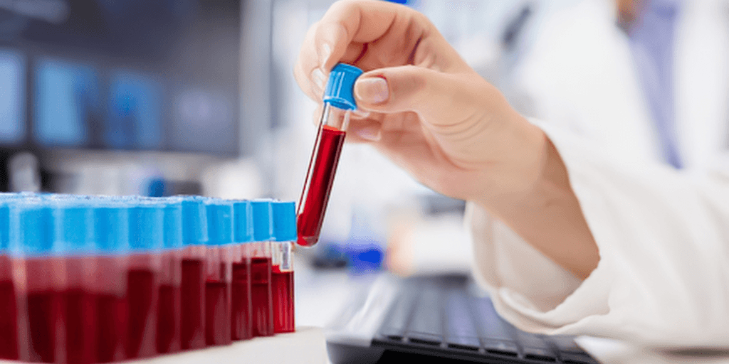 A hand holding a test tube above a rack of filled blood samples
