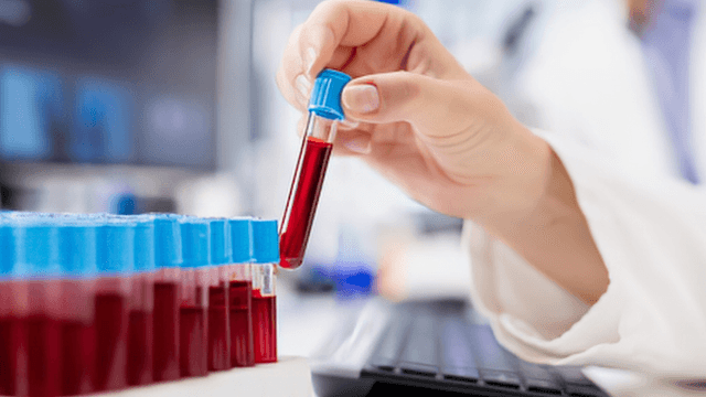 A hand holding a test tube above a rack of filled blood samples