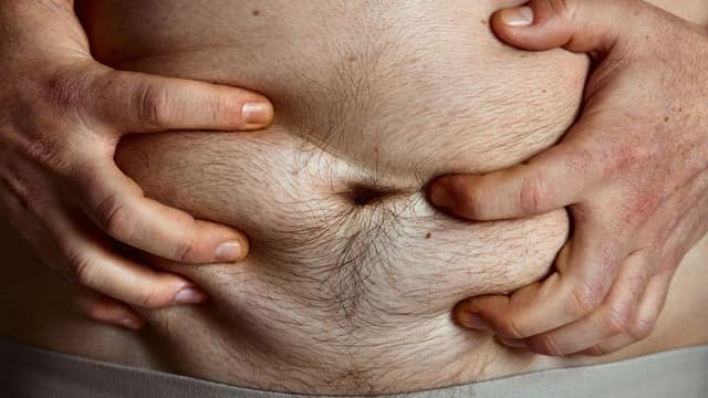 Study Reveals Key Factor in Fatty Liver Disease Mortality