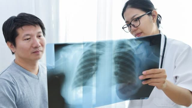 Researchers Identify Tumour-Survival Protein; Blocking It Shrinks Lung Cancer in Mice