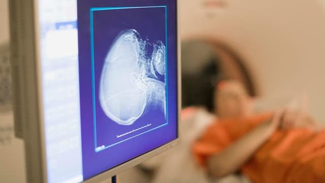 Mayo Clinic Initiates First-in-Human Trial of Targeted Radiopharmaceutical for Liver Cancer