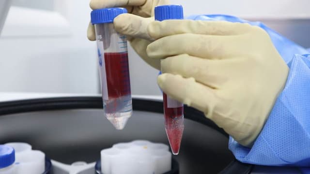 New Blood Test Detects HPV-Linked Cancers Years Before Diagnosis