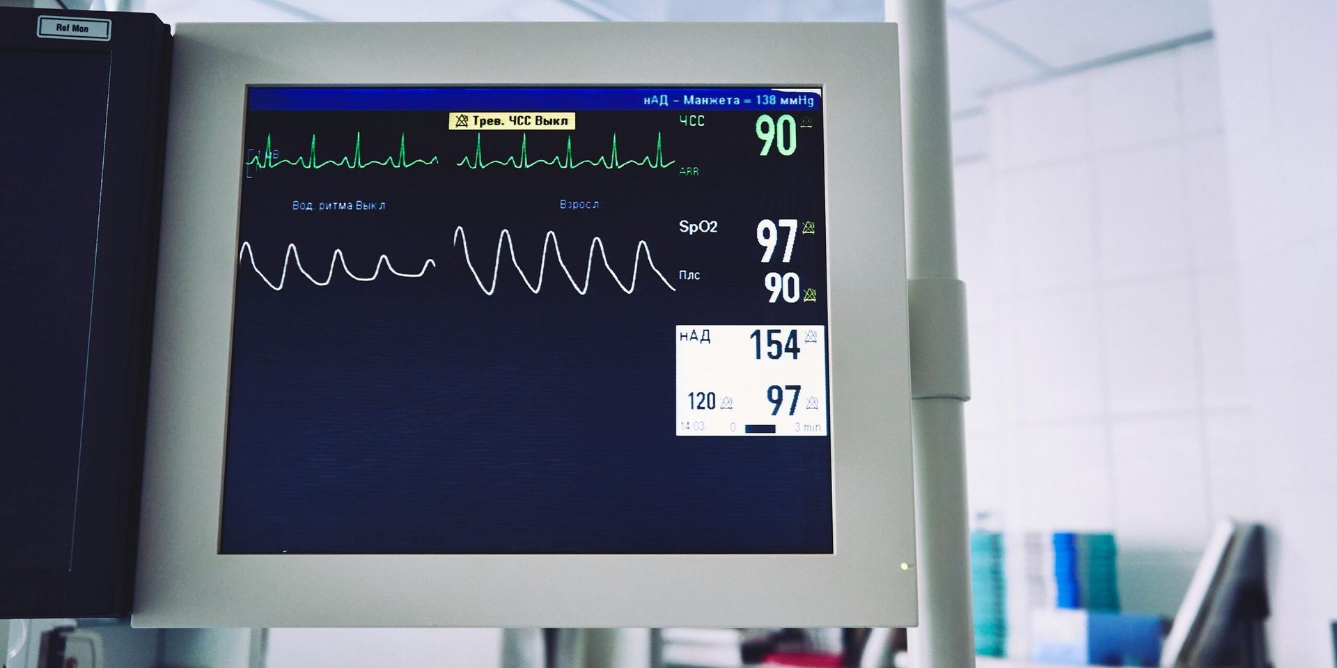New Study Finds Heart-Attack Risk Calculators Miss Nearly Half of Future Cases