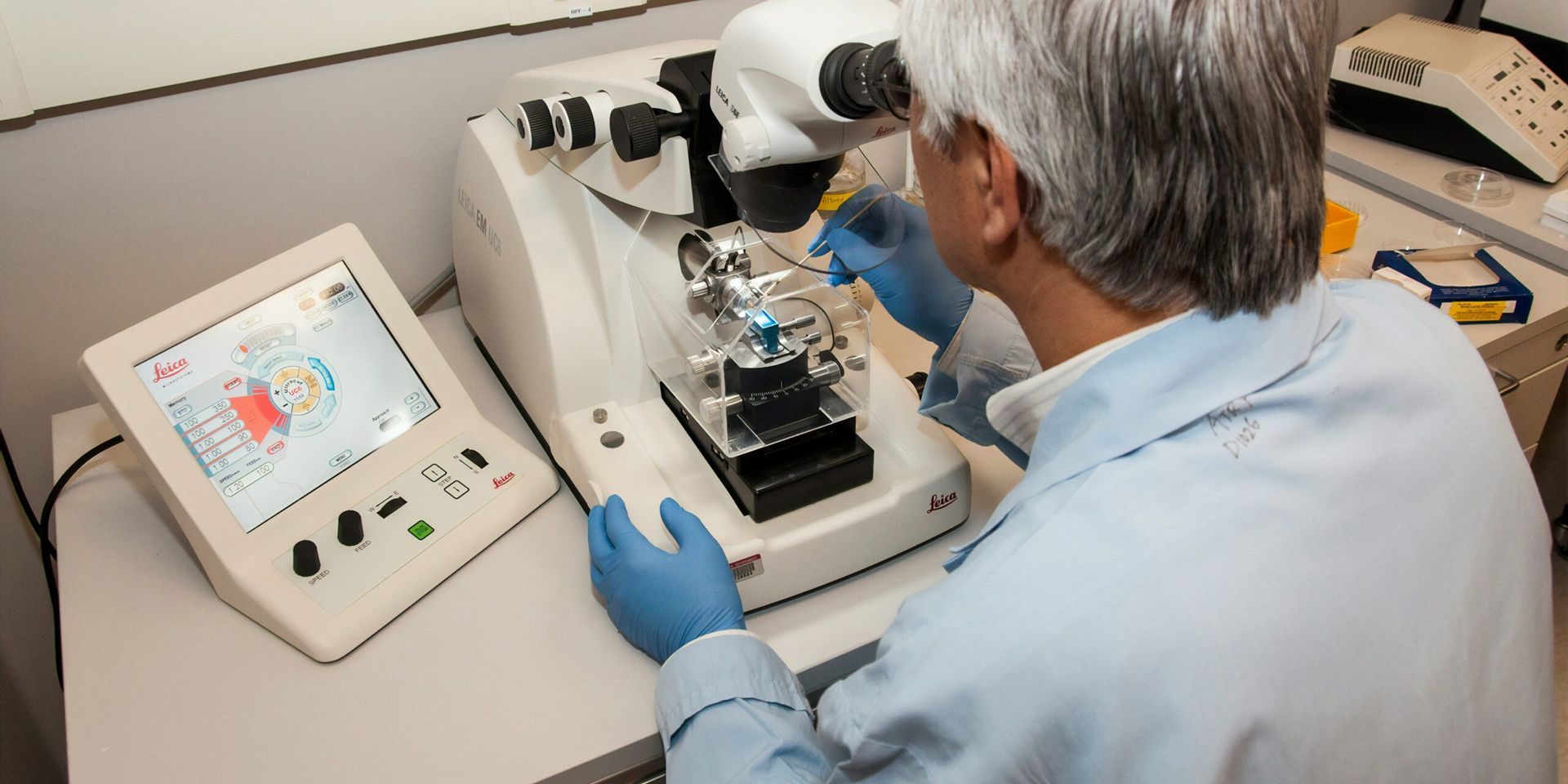 New Genomic Test Could Revolutionize Early-Stage Melanoma Care