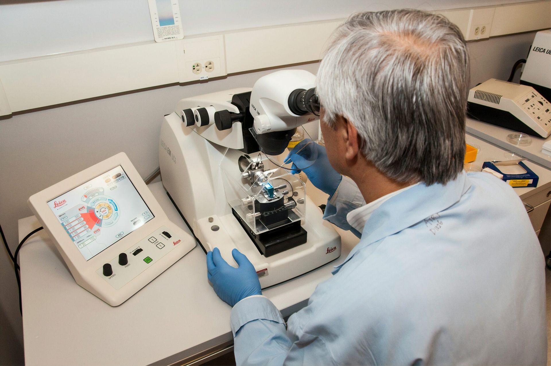 Breakthrough in Alzheimer’s Detection: Blood Test Accurately Diagnoses Early-Stage Disease