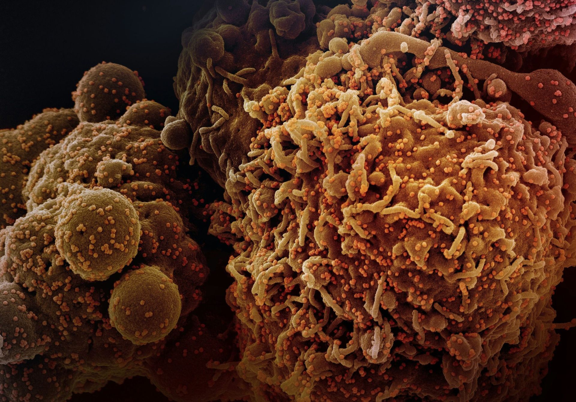 Revolutionary Cancer Therapy Using AI-Designed Drugs Shows Promising Results