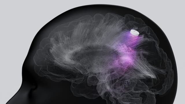 Scientists Reverse Memory Loss by Powering the Brain’s Tiny Engines