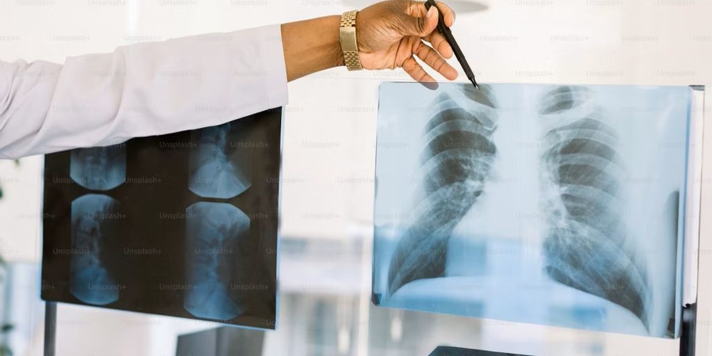 New Studies Highlight Early Detection in Lung Cancer and Biomarkers for Suicide Risk