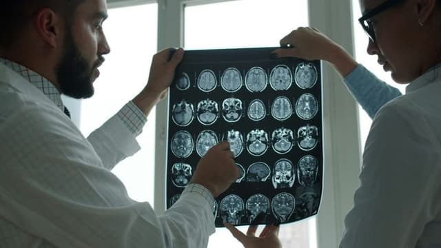 New Study Suggests DMT Could Limit Brain Damage After Stroke, Opening New Frontier in Neuroprotection